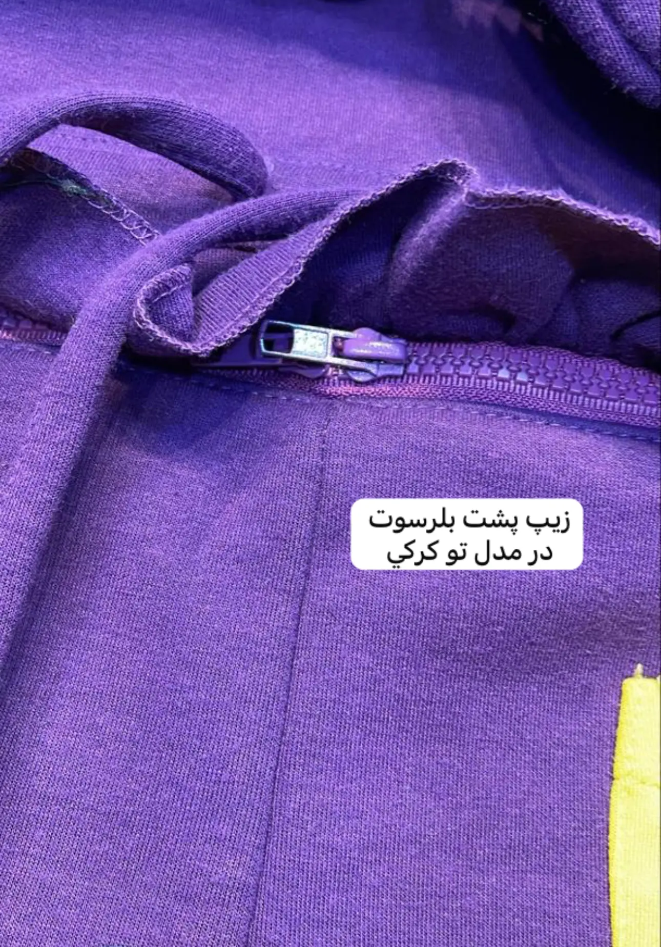 بلرسوت بارداري(كد ٧٧١)