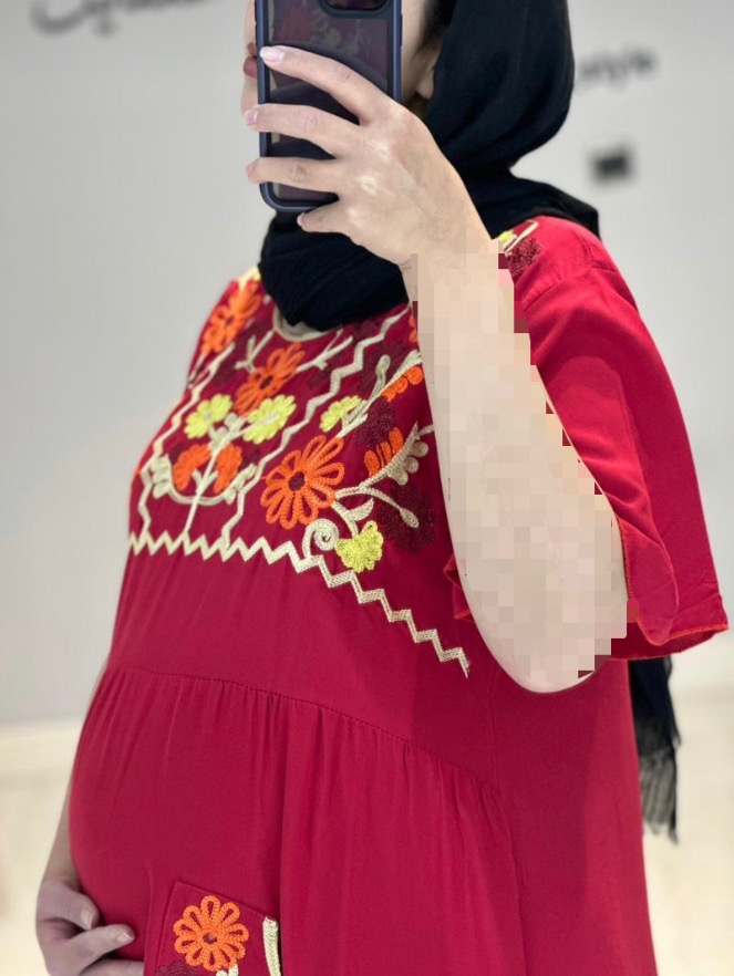 پیراهن بارداری نخی خامه دوزی (کد 618)